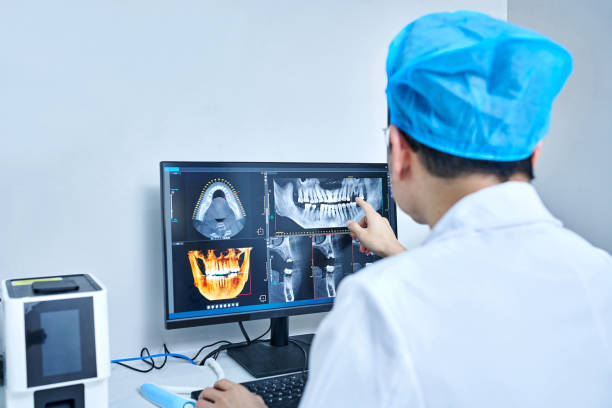 Best Emergency Tooth Extraction in Port Lavaca, TX
