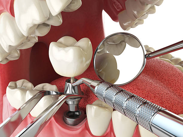Best Emergency Denture Repair in Port Lavaca, TX